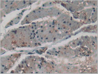 product-image-AAA20319_IHC6.jpg