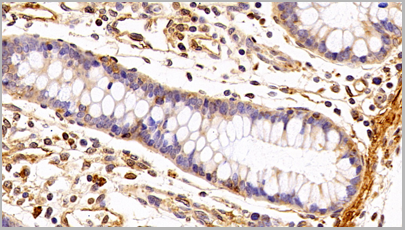 product-image-AAA20320_IHC10.png