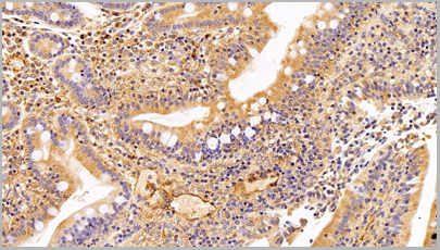 product-image-AAA20320_IHC11.png