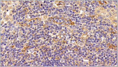 product-image-AAA20320_IHC12.png