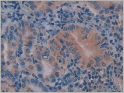 product-image-AAA20320_IHC4.jpg