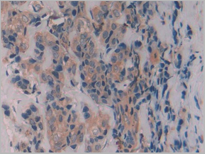 product-image-AAA20320_IHC5.jpg