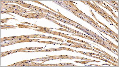product-image-AAA20320_IHC7.png