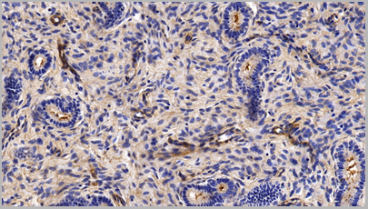 product-image-AAA20320_IHC8.png