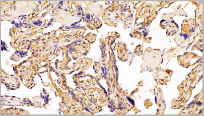 product-image-AAA20320_IHC9.png