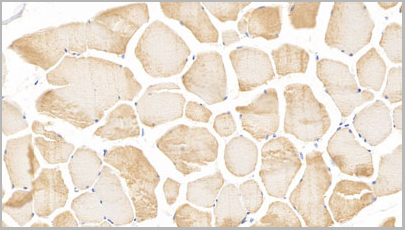product-image-AAA20817_IHC3.jpg