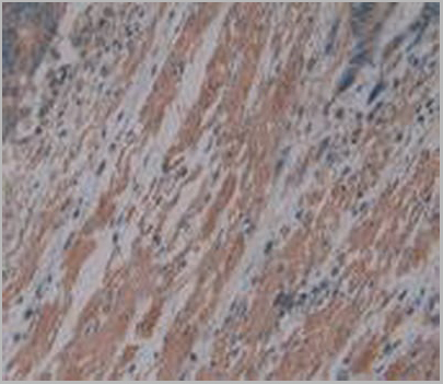 product-image-AAA20820_IHC3.jpg