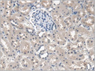 product-image-AAA20820_IHC4.jpg