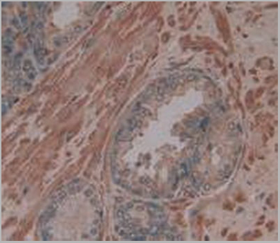 product-image-AAA20820_IHC5.jpg