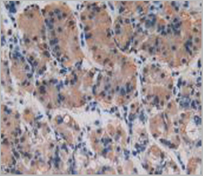 product-image-AAA20820_IHC6.jpg
