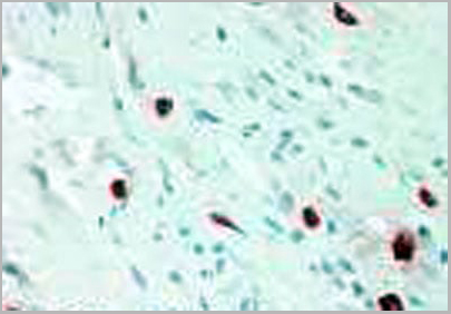 product-image-AAA20824_IHC.jpg