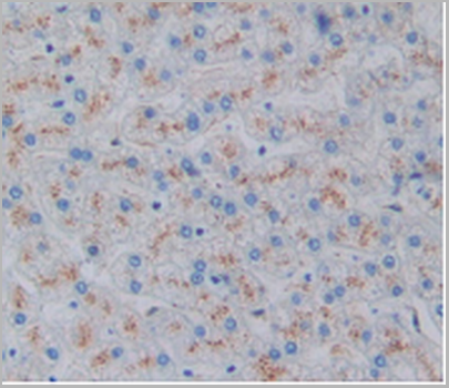 product-image-AAA20827_IHC3.png