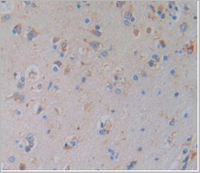 product-image-AAA20827_IHC4.png