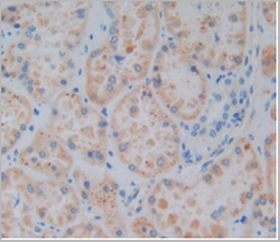 product-image-AAA20827_IHC5.png