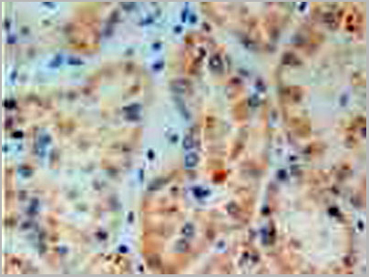 product-image-AAA20827_IHC6.jpg