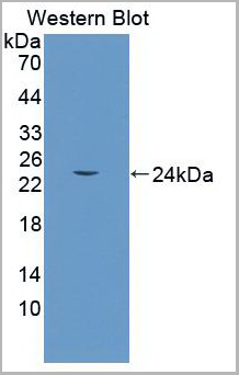 product-image-AAA20827_WB.jpg
