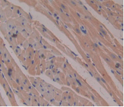 product-image-AAA20834_IHC3.png