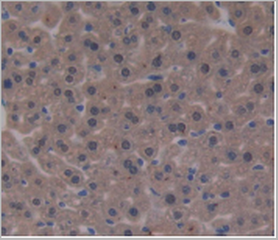 product-image-AAA20834_IHC4.png