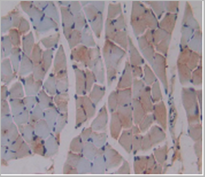 product-image-AAA20834_IHC5.png