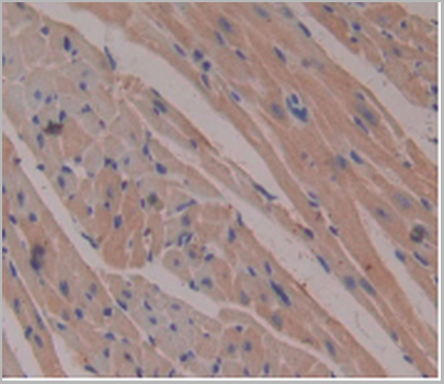 product-image-AAA20834_IHC6.png
