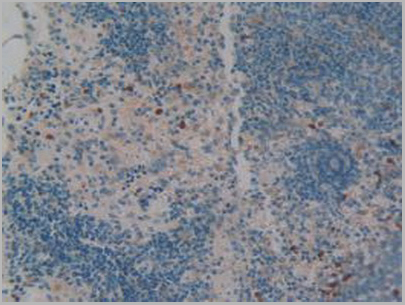 product-image-AAA20836_IHC3.jpg