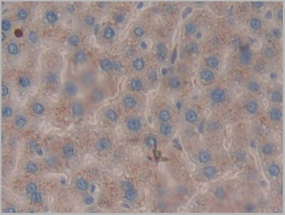 product-image-AAA20836_IHC4.jpg