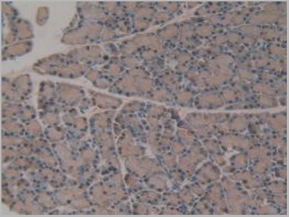 product-image-AAA20836_IHC5.jpg
