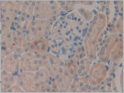 product-image-AAA20836_IHC9.jpg