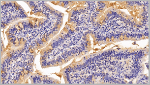 product-image-AAA20844_IHC4.png