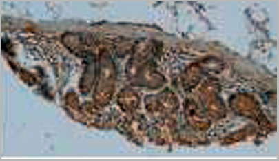 product-image-AAA20844_IHC5.jpg