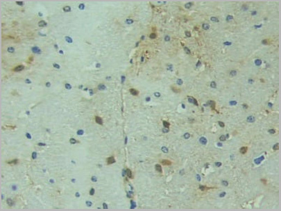 product-image-AAA20849_IHC4.jpg