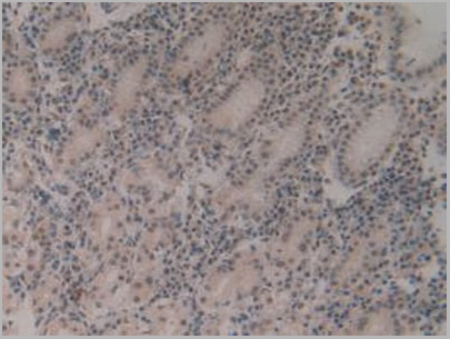 product-image-AAA20852_IHC4.jpg