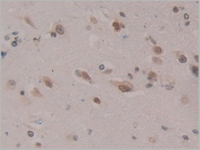 product-image-AAA20852_IHC5.jpg