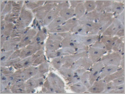 product-image-AAA20855_IHC5.jpg