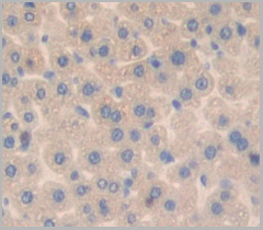 product-image-AAA20858_IHC5.jpg