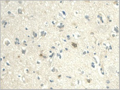 product-image-AAA20862_IHC6.jpg