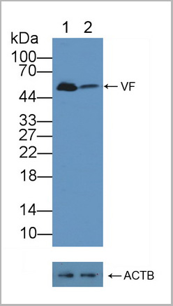 product-image-AAA20862_KO7.jpg