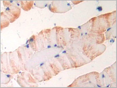 product-image-AAA20865_IHC2.jpg