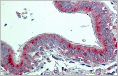 product-image-AAA20865_IHC5.jpg