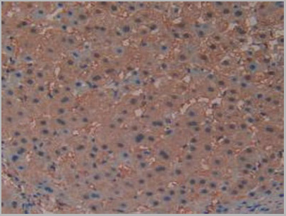 product-image-AAA20870_IHC4.jpg