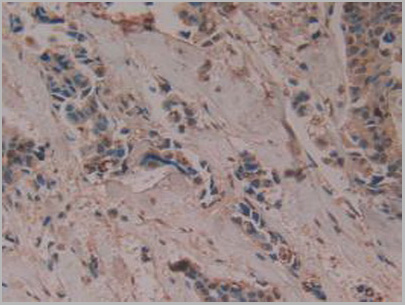 product-image-AAA20870_IHC5.jpg