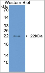 product-image-AAA20870_WB.jpg