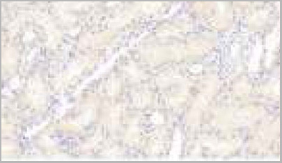 product-image-AAA20872_IHC.jpg