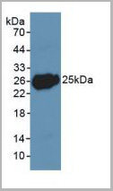 product-image-AAA20875_WB.jpg
