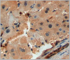 product-image-AAA20877_IHC3.jpg