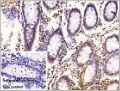 product-image-AAA20881_IHC3.jpg