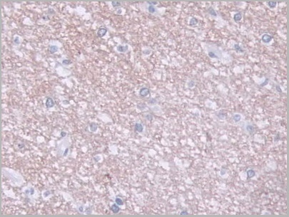 product-image-AAA20886_IHC3.jpg
