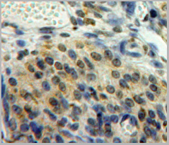 product-image-AAA20889_IHC6.jpg