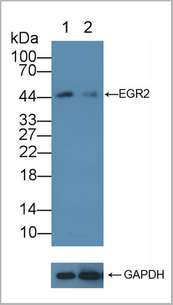 product-image-AAA20889_KO7.jpg