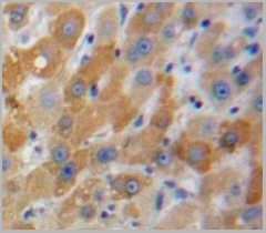 product-image-AAA20894_IHC5.jpg